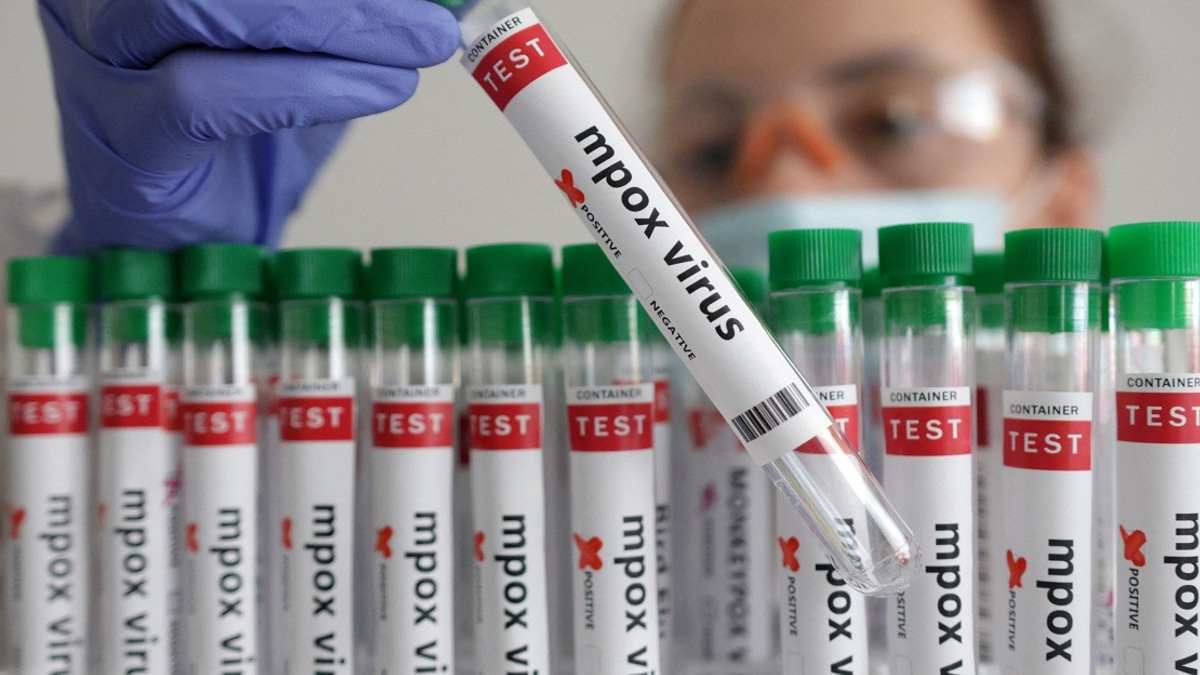 Guinea-Bissau Confirms First Mpox Case as Health Authorities Launch Containment Drive
