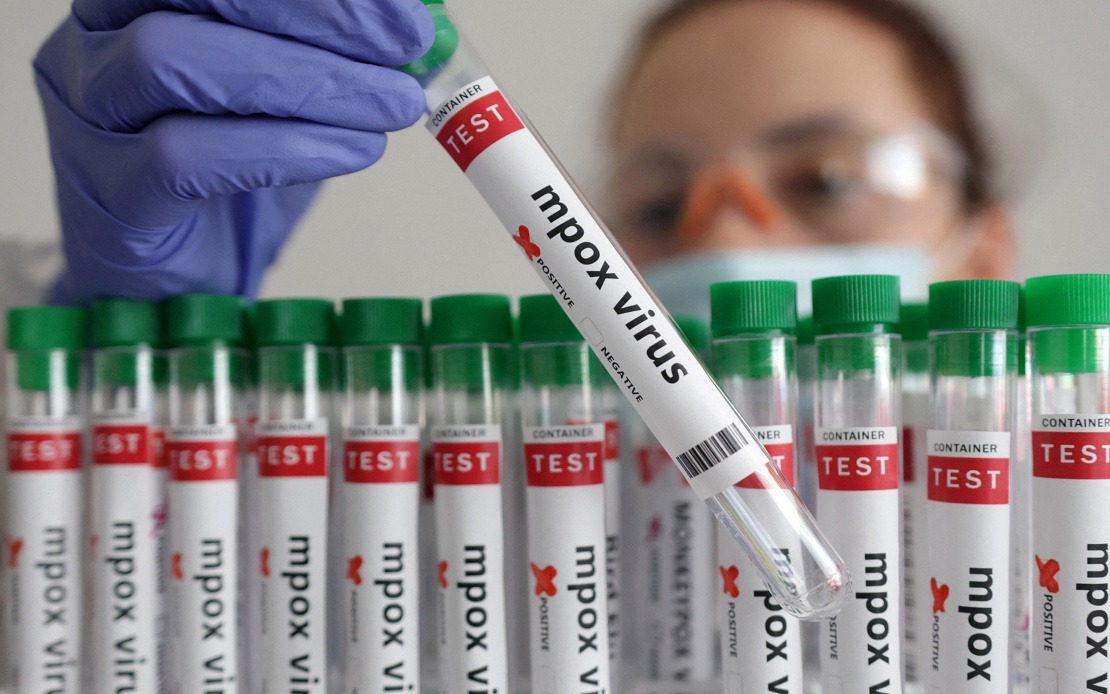Guinea-Bissau Confirms First Mpox Case as Health Authorities Launch Containment Drive